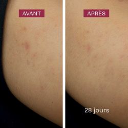 Crème de nuit anti-taches – Laboratoires Biarritz Laboratoires de Biarritz  dans votre magasin bio en ligne Etiketbio.eu